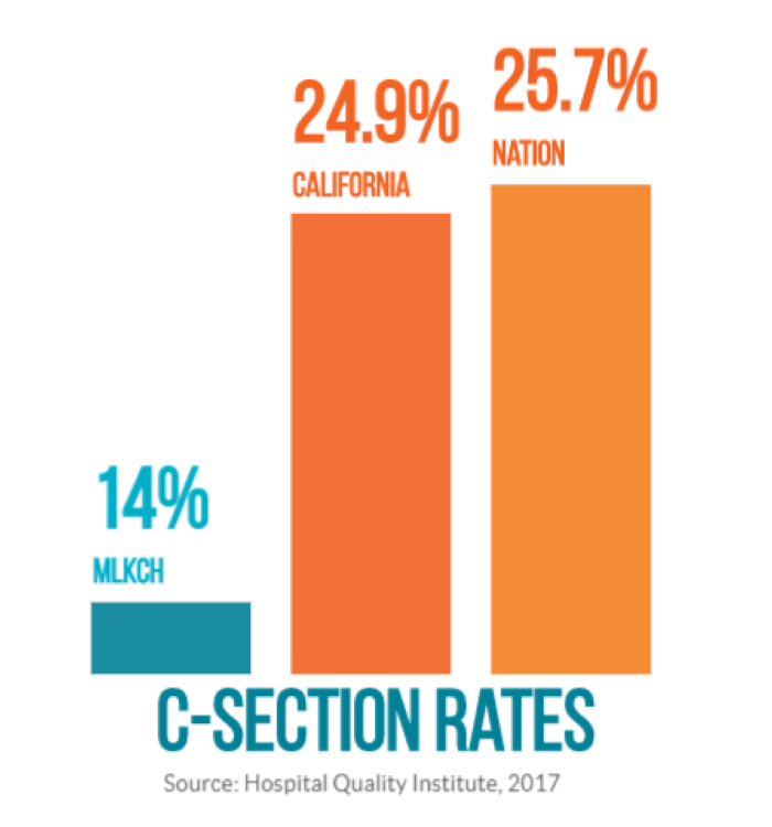 Bar chart for data comparing C-section rates. MLKCH is at 14 percent, California is at 24.9 percent and the nation is at 25.7 percent.