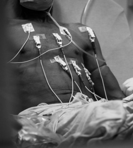 Foto de un paciente conectado a varios dispositivos
